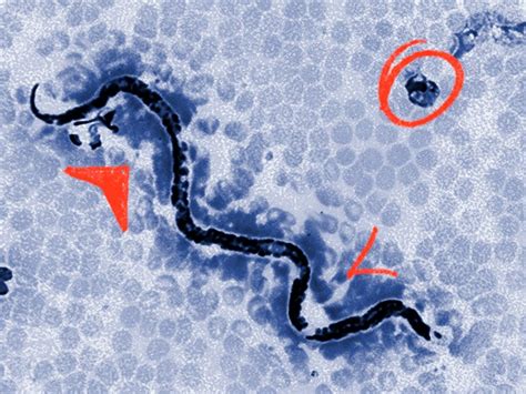  Urogonimus  – Un gusano intestinal que habita en aves acuáticas y provoca daños significativos al hígado