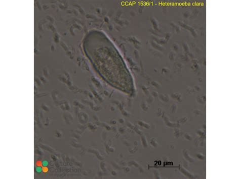  Heteramoeba! ¿Un Amoebozoos Conocido por sus Exquisitas Propiedades de Absorción?