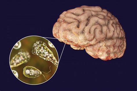  Naegleria Fowleri: ¿Un microorganismo invisible con la capacidad de invadir el cerebro humano?