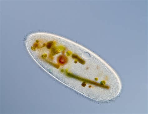  Quelonina: Un protista microscópico que desafía la clasificación tradicional ¡Descubre cómo este enigmático organismo unicelular se alimenta, se reproduce y navega por el mundo acuático!